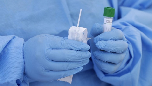 Украинские ученые разработали новые ПЦР-тесты, которые могут одновременно определить ковид и грипп